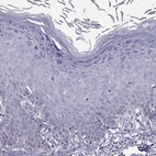 Immunohistochemical staining of human skin shows low expression as expected.