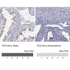 Anti-TEX13A Antibody