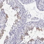 Immunohistochemical staining of human testis shows high expression.