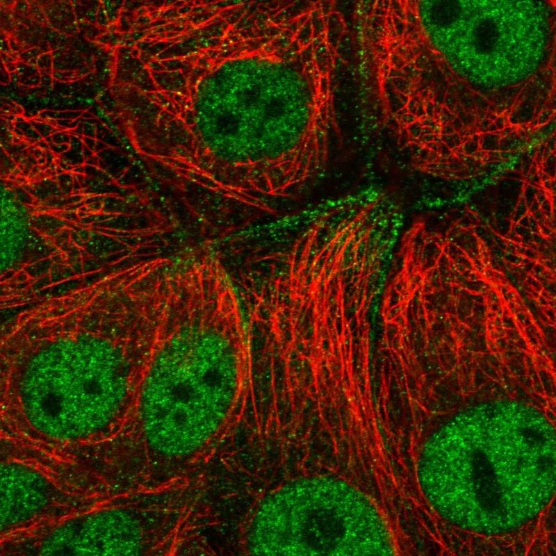 Anti-CFAP206 Antibody