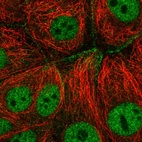 Anti-CFAP206 Antibody