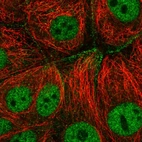 Anti-CFAP206 Antibody