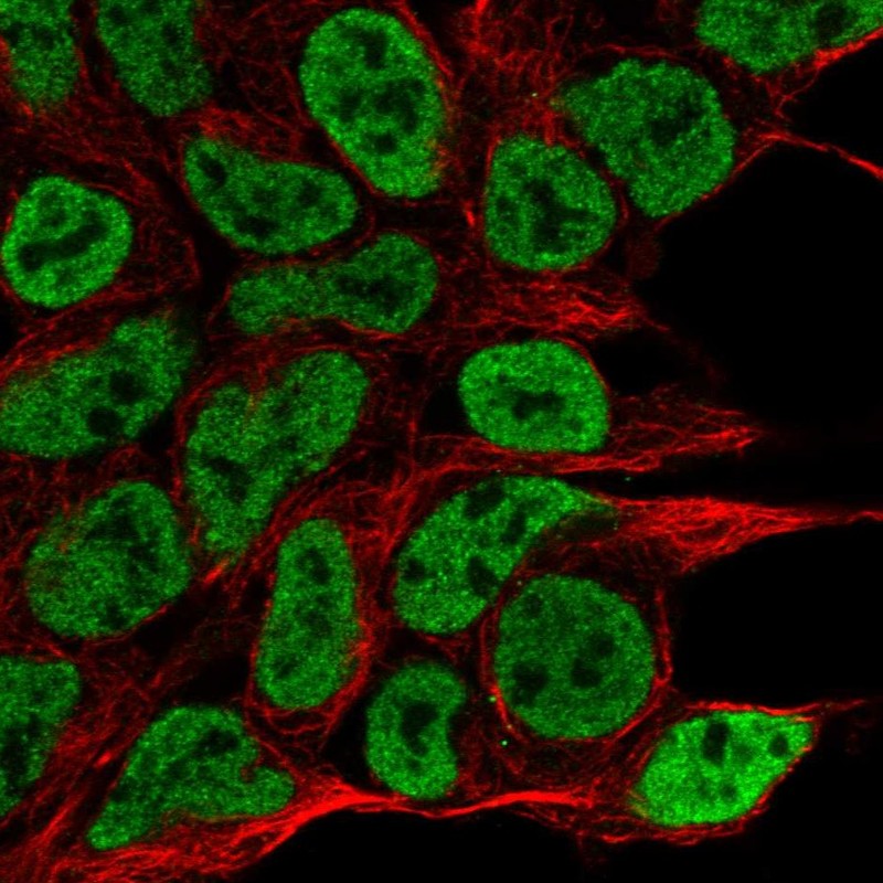 Anti-NPAS1 Antibody