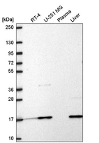 Western blot analysis in human cell line RT-4, human cell line U-251 MG, human plasma and human liver tissue.