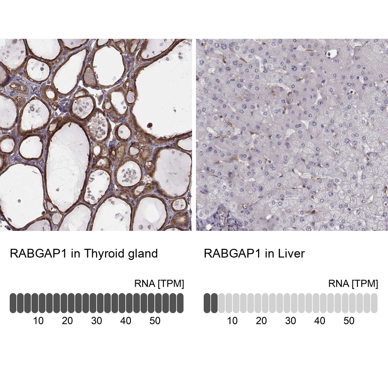 Anti-RABGAP1 Antibody