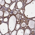 Immunohistochemical staining of human thyroid gland shows high expression.
