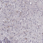 Immunohistochemical staining of human liver shows low expression as expected.