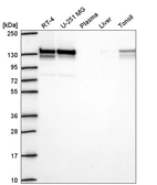 Western blot analysis in human cell line RT-4, human cell line U-251 MG, human plasma, human liver tissue and human tonsil tissue.