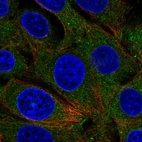 Immunofluorescent staining of human cell line MCF7 shows localization to cytosol.