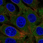 Immunofluorescent staining of human cell line MCF7 shows localization to cytosol.