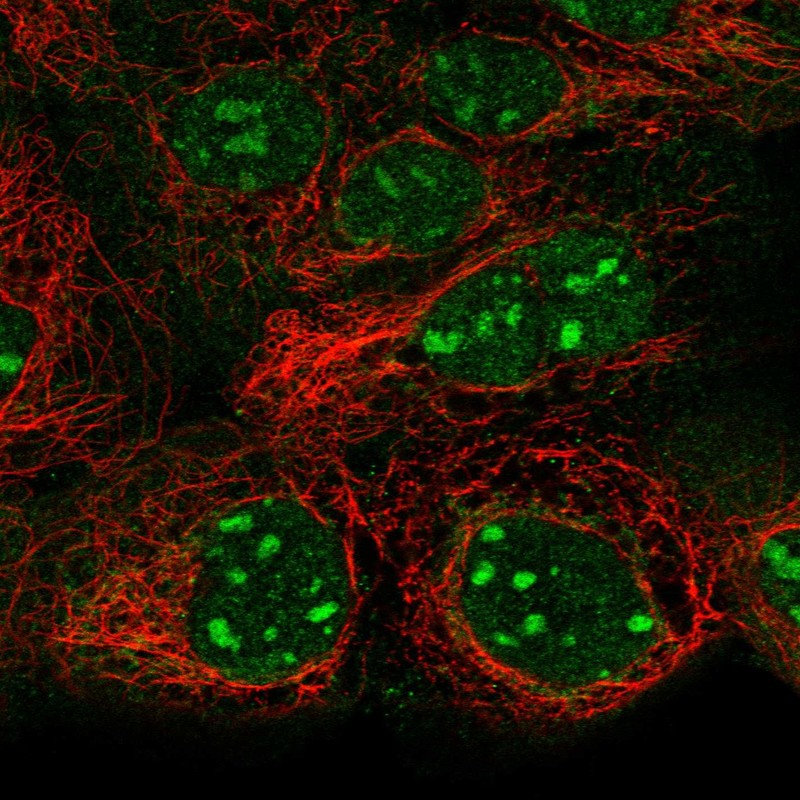 Anti-SNAPC1 Antibody