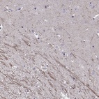 Anti-SNTG1 Antibody