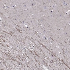 Anti-SNTG1 Antibody