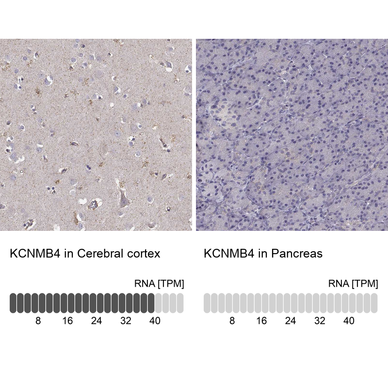 Anti-KCNMB4 Antibody