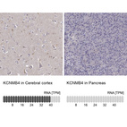 Anti-KCNMB4 Antibody