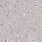 Immunohistochemical staining of human cerebral cortex shows high expression.