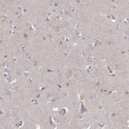 Immunohistochemical staining of human cerebral cortex shows high expression.