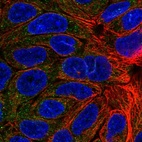 Immunofluorescent staining of human cell line RT4 shows localization to cytosol.