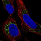 Immunofluorescent staining of human cell line U-2 OS shows localization to vesicles.