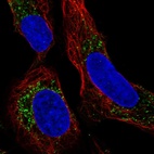 Anti-PMEPA1 Antibody