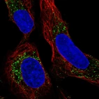 Immunofluorescent staining of human cell line U-2 OS shows localization to vesicles.