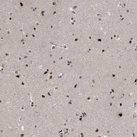 Anti-E4F1 Antibody