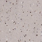 Anti-E4F1 Antibody