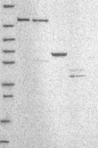 Lane 1: Marker [kDa] 250, 130, 95, 72, 55, 36, 28, 17, 10 | Lane 2: RT4 | Lane 3: U-251 MG | Lane 4: Human Plasma | Lane 5: Liver | Lane 6: Tonsil