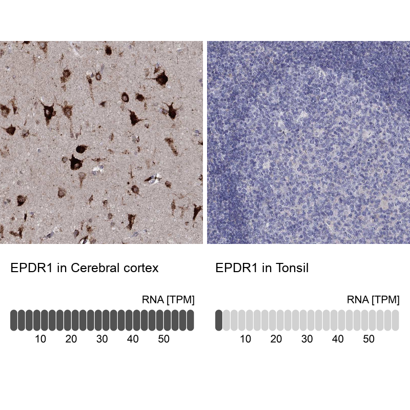 Anti-EPDR1 Antibody