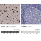 Anti-EPDR1 Antibody