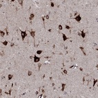 Immunohistochemical staining of human cerebral cortex shows high expression.