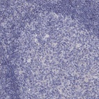 Anti-EPDR1 Antibody