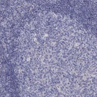 Immunohistochemical staining of human tonsil shows low expression as expected.