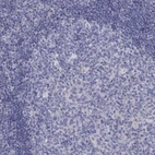 Immunohistochemical staining of human tonsil shows low expression as expected.
