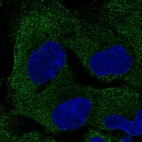 Anti-PAIP2B Antibody
