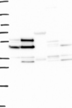 Lane 1: Marker [kDa] 250, 130, 95, 72, 55, 36, 28, 17, 10 | Lane 2: RT4 | Lane 3: U-251 MG | Lane 4: Human Plasma | Lane 5: Liver | Lane 6: Tonsil