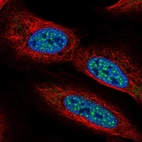 Anti-CBFA2T2 Antibody