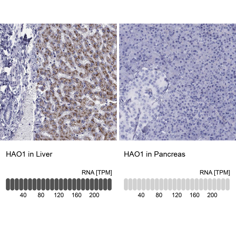 Anti-HAO1 Antibody