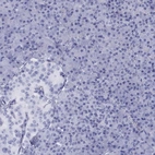 Immunohistochemical staining of human pancreas shows low expression as expected.