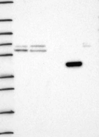 Lane 1: Marker [kDa] 250, 130, 95, 72, 55, 36, 28, 17, 10 | Lane 2: RT4 | Lane 3: U-251 MG | Lane 4: Human Plasma | Lane 5: Liver | Lane 6: Tonsil