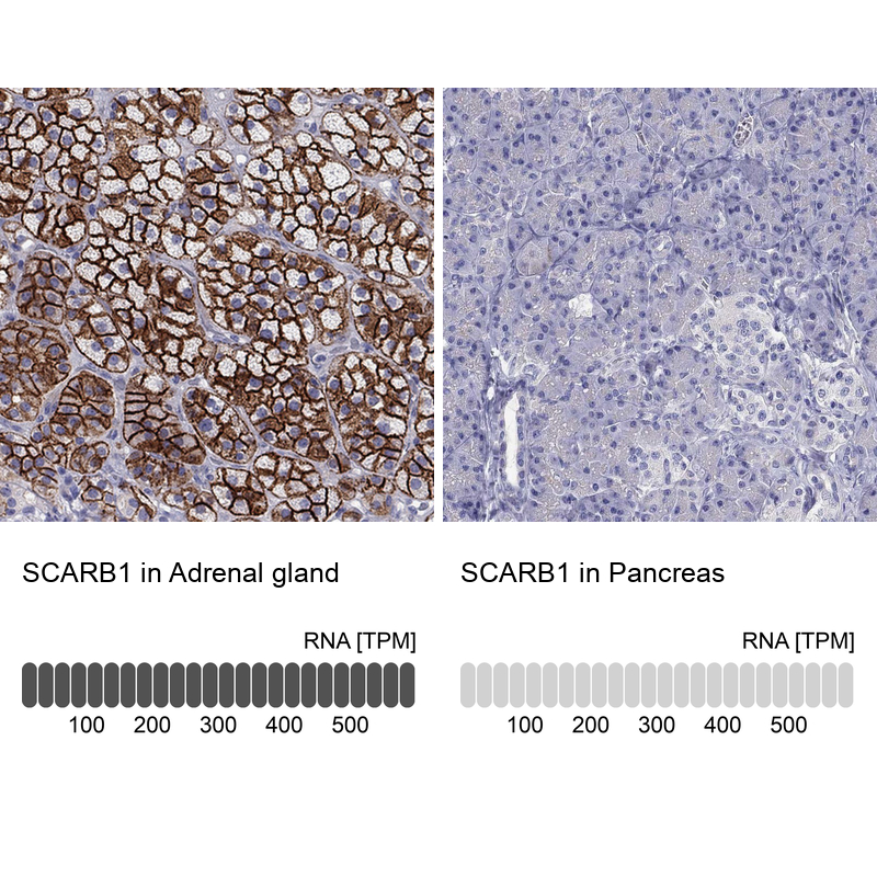 Anti-SCARB1 Antibody