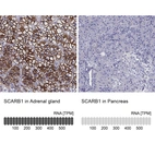 Anti-SCARB1 Antibody
