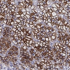 Immunohistochemical staining of human adrenal gland shows high expression.