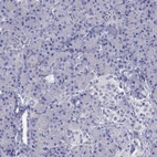Immunohistochemical staining of human pancreas shows low expression as expected.