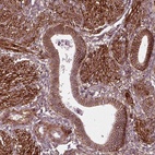 Anti-NPTN Antibody