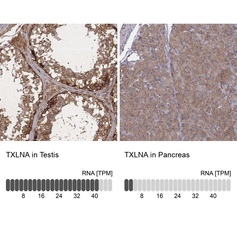Anti-TXLNA Antibody