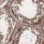 Immunohistochemical staining of human testis shows high expression.