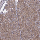 Immunohistochemical staining of human pancreas shows low expression as expected.
