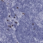 Immunohistochemical staining of human lymph node shows high expression.