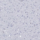 Immunohistochemical staining of human cerebral cortex shows low expression as expected.